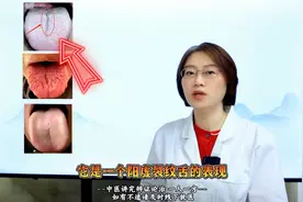阳虚裂纹舌，精亏裂纹舌，气血虚裂纹舌，教你三招对证调图片