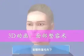 HIV也可以做整形了！！！#HIV植发图片