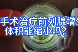 非手术治疗前列腺增生，体积能缩小吗？图片