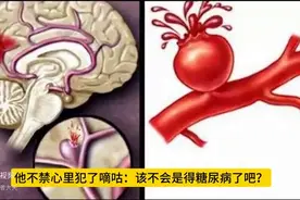空腹血糖8.3，算严重吗？医生坦言：这3种情况，可能无需治疗图片