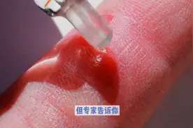 伤口结痂为什么不能撕扯？#科普图片