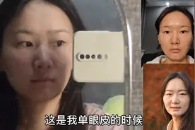 记录双眼皮蜕变过程 终于摆脱容貌焦虑，摆脱大小眼和超级肿眼泡图片