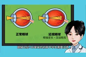 高度近视不能做那些运动？#专业验光配镜图片