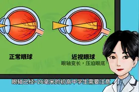 高度近视不能做那些运动？#专业验光配镜图片