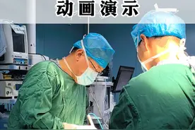藏毛窦的手术过程。#藏毛窦 #肛肠健康 #肛肠医生张国云  #硬核健康科普行动视频封面