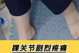 踝关节剧烈疼痛？小心长骨刺！ #踝关节痛 #骨刺视频封面