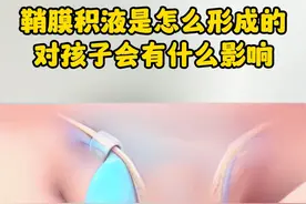 鞘膜积液是怎么形成的，对孩子会有什么影响。 #武汉同济李宁医生#医学科普 #鞘膜积液 #硬核健康科普行动  #疝气视频封面