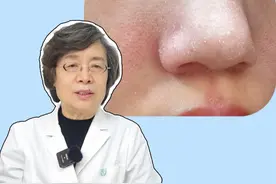 脸上起皮，可能不是单纯的干燥，而是面部#脂溢性皮炎 ！#皮肤干燥 #医学科普 #涨知识 #科普视频封面