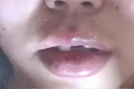 女子骑车被电车绊倒，门牙摔掉俩。“天天做噩梦，梦见被撞这一刻!”交警:电车车牌是假的，属于肇事逃逸。#都市接到办视频封面