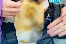 吻合口狭窄  造口要怎样才能回纳？ #胃肠专家张万福教授  #胃肠健康  #硬核健康科普行动   #医疗健康创作训练营 #造口人视频封面