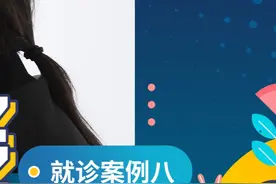 额部脂肪填充过多 就诊案例八（术后） #额头吸脂 #额部脂肪填充 #内窥镜额部除皱 #额头不平 #眉压眼 内窥镜除皱，内窥镜除皱提升视频封面