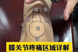 膝关节疼痛区域详解 #膝关节疼痛 #骨科 #医学科普 #骨科赵立勇 #硬核健康科普行动