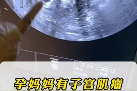 孕妈妈有子宫肌瘤怎么办？ 子宫肌瘤对宝宝有无影响呢？#子宫肌瘤 #孕期记录 #不孕不育 #生殖健康 #试管婴儿视频封面