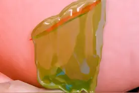 胃酸的腐蚀性极强，胃壁为什么不会被它溶解呢？ #艺术在抖音视频封面