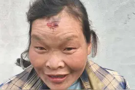 重庆市寻亲：六旬老太被救助，自述叫小琴，高1米52图片