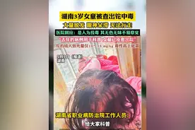 湖南3岁女童被查出铊中毒，大量脱发 眼神呆滞 无法行走，医院回应：是人为投毒 其无色无味不易察觉，“去年的病例用于科普 女童已痊愈出院”（畅）