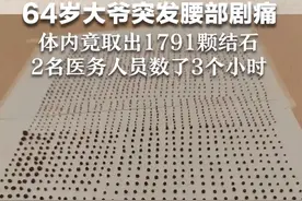 64岁大爷突发腰部剧痛 体内竟取出1791颗结石 2名医务人员数了3个小时视频封面