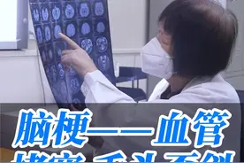 脑梗的症状有哪些？舌头歪斜、一侧手脚无力等，都是脑梗的症状。#医学科普 #门诊日常 #脑梗 #舌头歪斜 #医者仁心视频封面