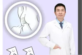屁股缝里的毛毛，你会拔掉吗？#趣味科普 #冷知识 #屁屁