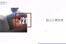 胎儿“一过性”心律失常的超声表现 #胎儿心脏视频封面