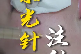 怕疼的人，水光针选机打还是手打？ #整形医生杨云 #云南抗衰 #水光针 #美白淡斑提亮肤色 #补水 @抖音健康使用计划 @抖音短视频视频封面
