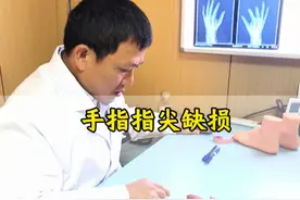 手指指尖缺损，手指再造手术（二） #再造 #手足外科 #骨科 #硬核健康科普行动 #医疗创作者培优计划 @抖音创作小助手 @抖音健康使用计划 @DOU+小助手视频封面