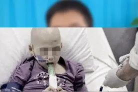 不要以为白血病离你很远，家长要多关注，防患于未然。#医学科普 #关注健康 #科普一下 #健康科普 