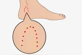 被蛇咬了可从伤口形状判断有没有毒 视频封面