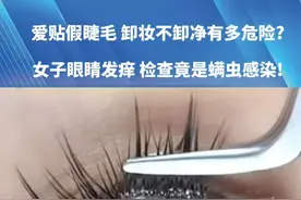 爱贴假睫毛 卸妆不卸净有多危险?女子眼睛发痒 检查竟是螨虫感染! #社会百态  #万万没想到视频封面