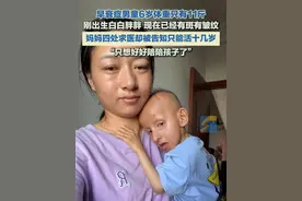 早衰症男童6岁体重只有11斤 刚出生白白胖胖现在已经有斑有皱纹 妈妈四处求医却被告知只能活十几岁#早衰症 #揪心 #可怜天下父母心视频封面