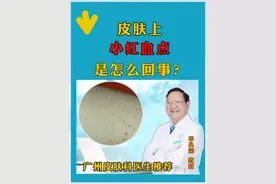 皮肤上小红血点是怎么回事？ #医疗小常识 #银屑病小知识 #广东皮肤病医生推荐 #单孔荣医生 #硬核健康科普行动