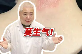 脖子、手肘等部位痒的受不了，抓出了红斑，还增厚，一定要警惕是#神经性皮炎 #硬核健康科普行动  #入冬换季不患疾 #涨知识 #莫生气视频封面