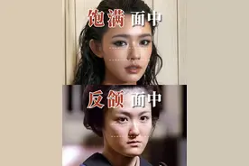地包天为什么会让面中凹陷？ #正畸许跃 #地包天 #反颌 #面中凹陷 #鼻基底凹陷视频封面