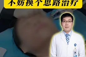 ✨ 痘坑终结者｜1+1＞2的平坑黑科技！ 💥 别再死磕点阵激光治疗痘坑了！
痘坑修复新思路：黄金微针+中长效水光填充
🔥 原理大揭秘
1⃣ 黄金微针：微针穿刺+射频热能双重作用，直接刺激真皮层胶原再生，填平凹陷痘坑，同时收紧毛孔
2⃣ 中长效水光填充：含透明质酸、胶原蛋白的“液态支架”，深层填充痘坑凹陷，即刻撑起塌陷皮肤，长效维持水润嘭弹感。
💎 CP组合优势
✅ 双效叠加：黄金微针修复基底结构，水光填充即时“填坑”，1次治疗=平整度+水润度同时提升!
✅ 恢复期短：微针创口3天愈合，水光针无恢复期，打工人真的很友好！
✅ 精准适配：尤其适合车厢型、滚筒型痘坑，对毛孔粗大、皮肤粗糙真的可！

🚨特别提醒
⚠ 单做微针见效时间比较久，疗程较长，叠加水光可缩短疗程；
⚠ 术后72小时是修复黄金期，注意做好保湿补水+防晒！
⚠ 认准「械字号」产品，自身护理和医生经验缺一不可！
#天天dou是315    #抖出健康知识宝藏     #健康无畏自在如她    #痘坑  #痘坑修复视频封面