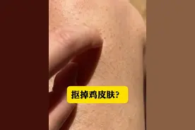别再抠胳膊大腿疙疙瘩瘩的鸡皮肤了， 皮肤科医生教你一招低成本的处理方法。#鸡皮肤  #疙瘩  #鸡皮疙瘩  #硬核健康科普行动   #黑印