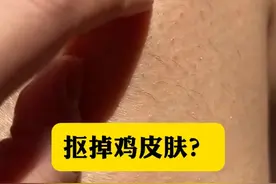 别再抠胳膊大腿疙疙瘩瘩的鸡皮肤了， 皮肤科医生教你一招低成本的处理方法。#鸡皮肤  #疙瘩  #鸡皮疙瘩  #硬核健康科普行动   #黑印视频封面