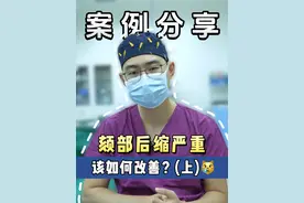 下巴严重后缩，不想做大手术，该怎么办？ #下巴后缩 #垫下巴 #颏成型 #八大处马晓阳 #手术日常视频封面