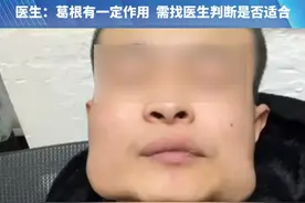 小伙嚼槟榔变“国字脸”，想通过葛根戒掉槟榔，医生：葛根有一定作用  需找医生判断是否适合#媒体精选计划  #河南dou知道视频封面
