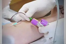 你知道HIV确诊，是怎么通知患者的吗？ #艾滋病 #世界艾滋病日视频封面