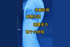 含胸驼背 肩膀内扣 塌腰无力 两个小妙招 #含胸驼背 #肩膀内扣 #塌腰无力 #体态不良 #抖出健康知识宝藏