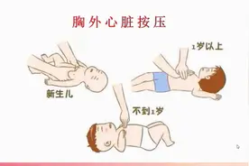 21.11胸外心脏按压步骤##知识科普 #中医养生 #医学知识科普视频封面