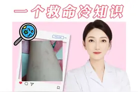 你们身上这种黑印子多吗？#医学知识科普 #抖出健康知识宝藏视频封面