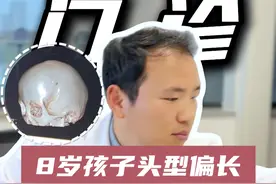 8岁孩子头型偏长，CT确诊狭颅症 如果头型感觉有异常，尽量早些来看医生，否则可能会错过最佳治疗时间。#医生日常 #门诊日常 #诊室日常 #育儿 #颅缝早闭视频封面