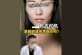 #脂肪填充 后，“觉得”面部部队成，是#面填 导致的吗？每一个人的脸本来就是不对称的，十年前填充后十年后不对称，很大原因是自身骨骼原因，因为衰老以后，更加显现了。#注射提升韩雪峰 #硬核健康科普行动  #北京八大处注射视频封面