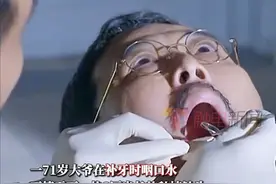 近日，浙江一名71岁的老人在根管治疗时，不小心吞下了一枚3厘米长的种植钻头，钻头顺着喉咙一路向下，卡在了小肠里。大爷称，“诊所里的牙医开始还没敢告诉我是什么东西掉进去了”。随后大爷被紧急送到浙江大学医学院附属第一医院，经手术，大爷已平安出院。视频封面