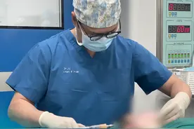 40秒揭秘清晰下颌线速成术过程！ #双下巴消失术 #下颌线清晰 #脂肪堆积 #皮肤收紧 #医学科普