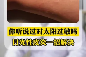  一晒太阳就起红点，特别的痒，可能和这个有关！#医学科普  视频封面