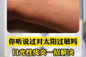  一晒太阳就起红点，特别的痒，可能和这个有关！#医学科普  视频封面