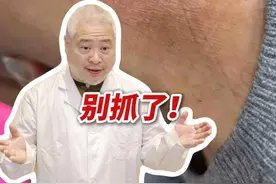 脖子上反复长红斑，痒，忍不住抓❗这是#神经性皮炎 ，医生教你正确处理#抖出健康知识宝藏  #科普 #情绪 #开工去班味健康指南视频封面