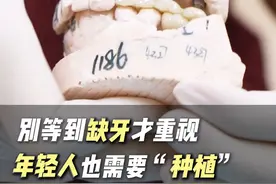 种植牙大工程：20+岁缺10颗牙 #种植牙 #口腔科普 #舒林径 #硬核健康科普行动 #缺牙